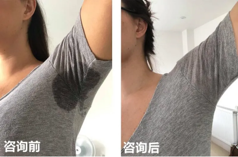 1642214856116680.png image.png